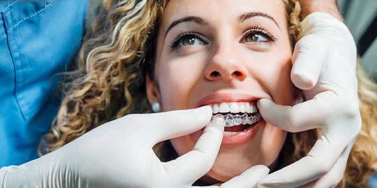 Close up of dentist checking patients’ Invisalign